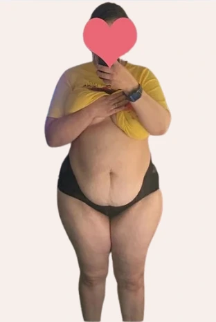 Depois de usar BodyGlam